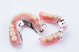 metal dentures