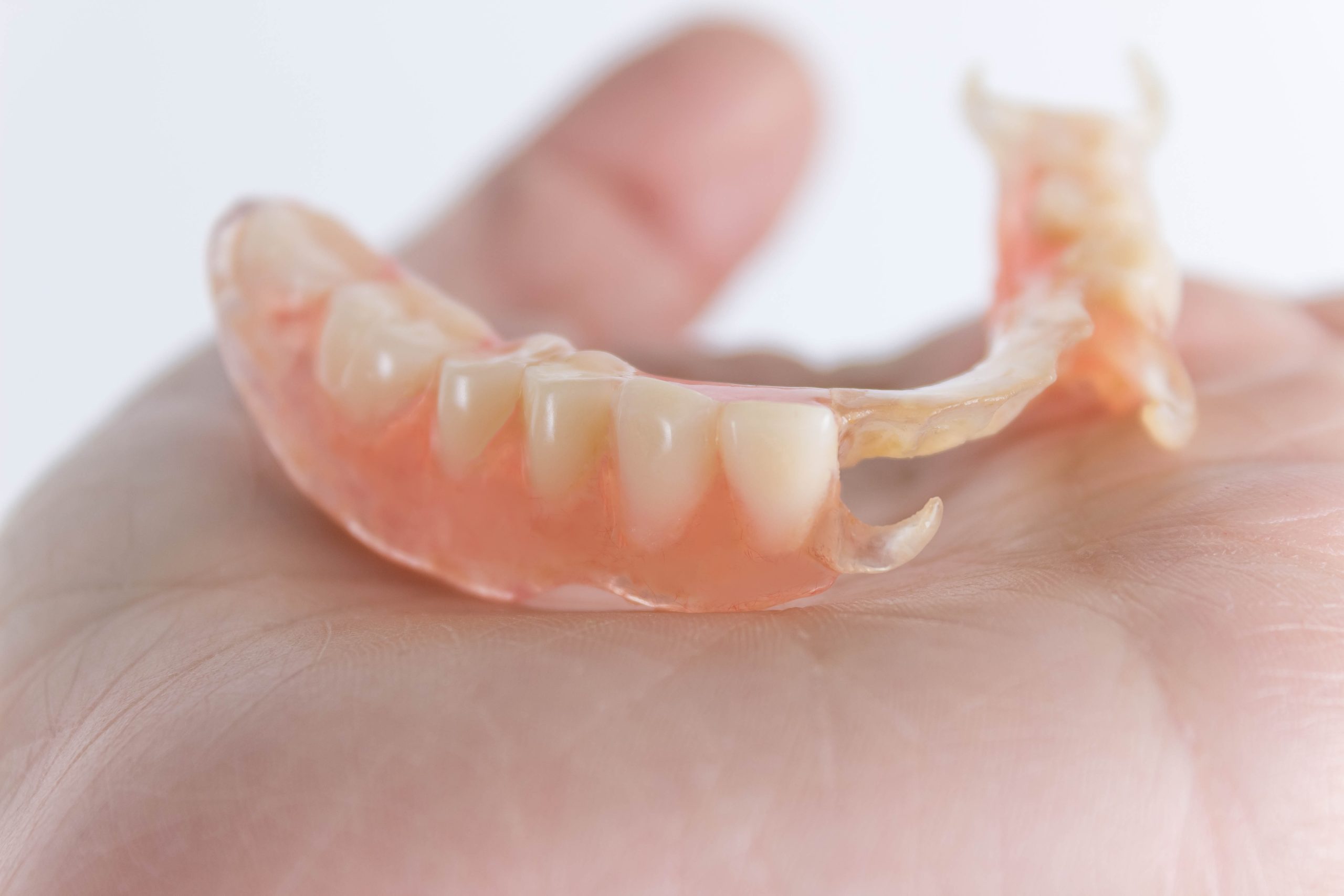 removable denture