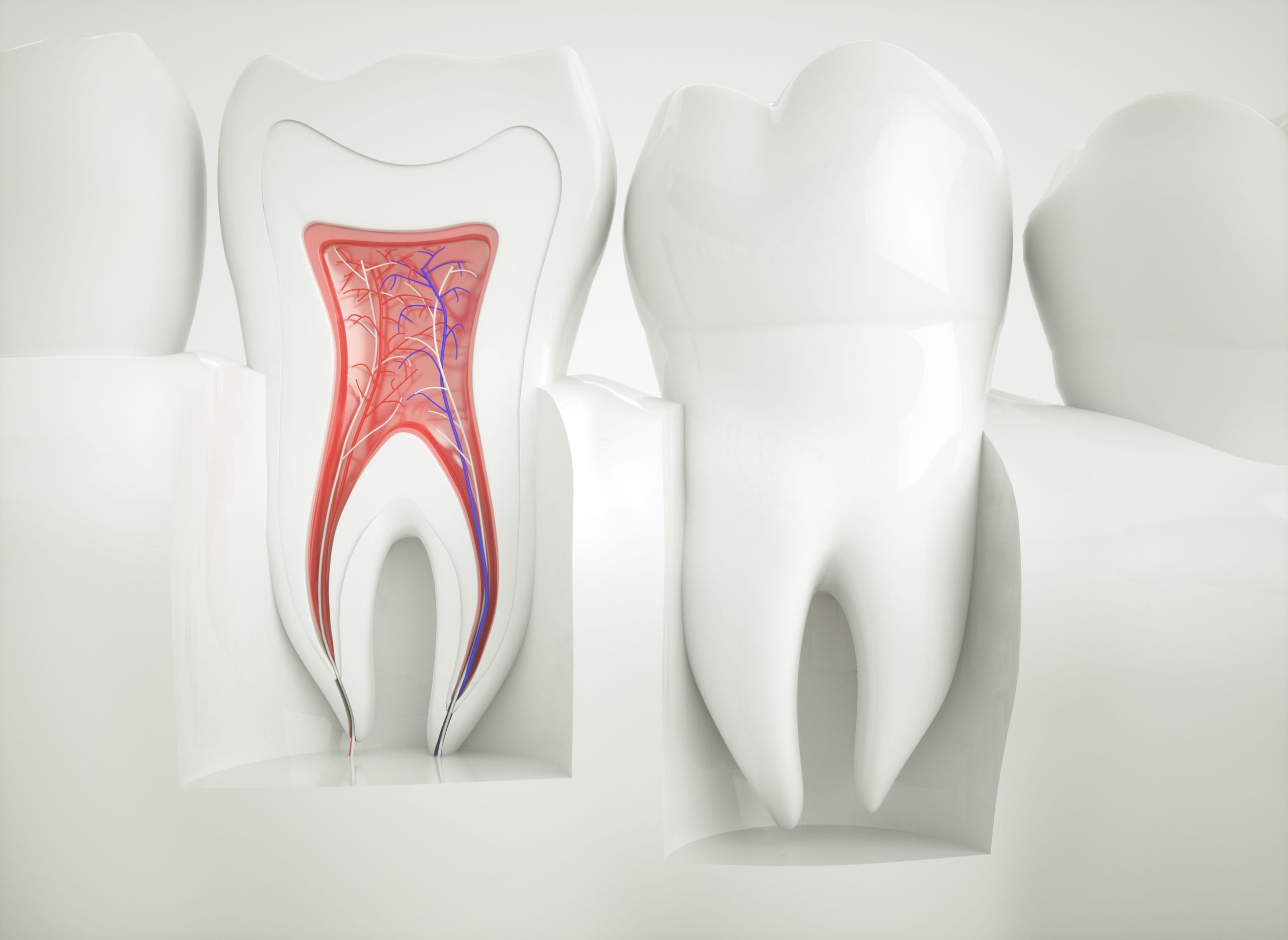 root canal cost