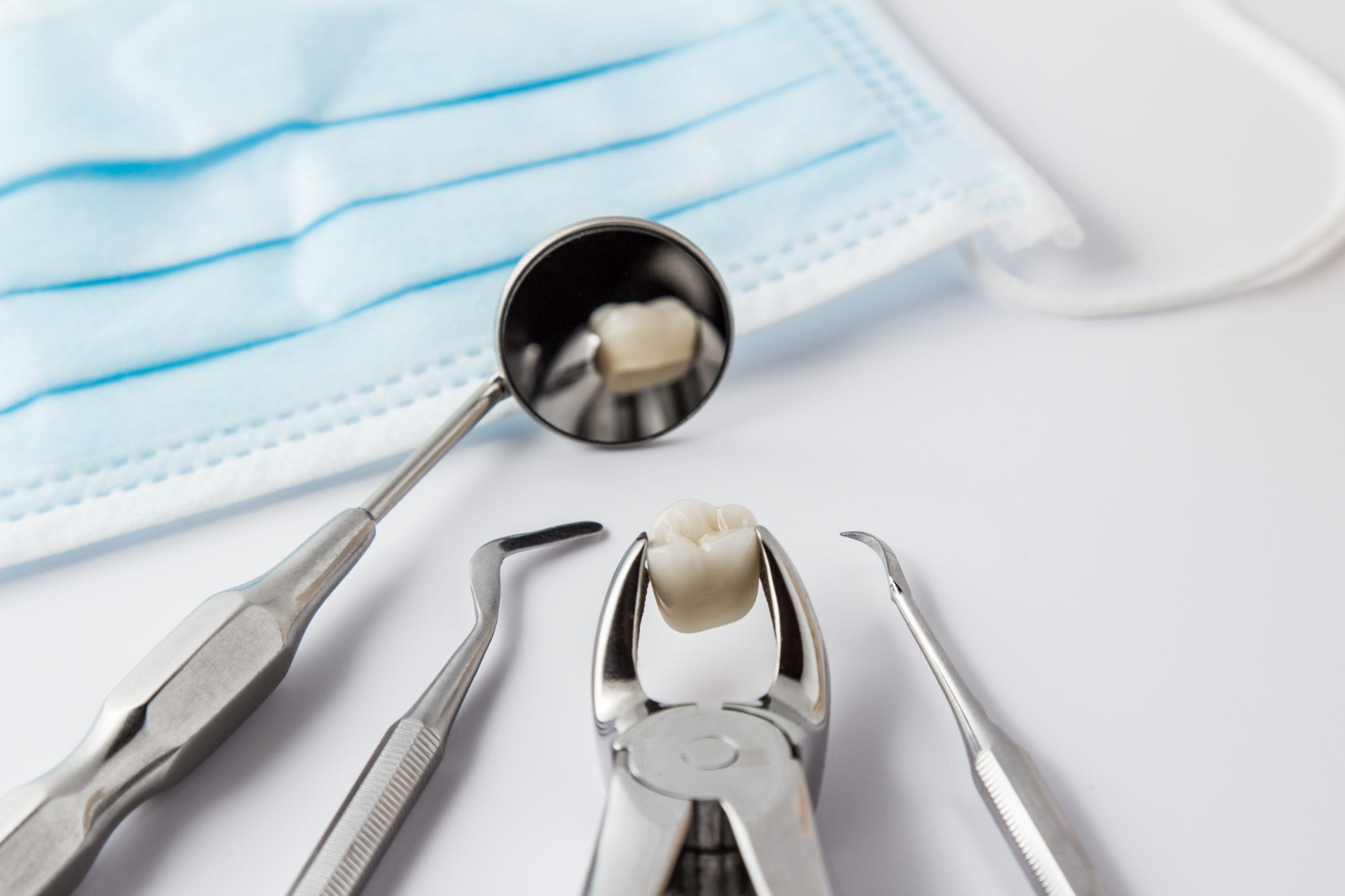 wisdom tooth extraction