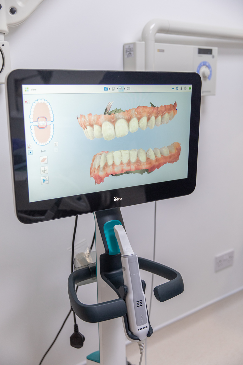 Cerec in Hammersmith: one-visit restorations for busy lives