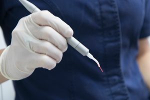 laser dentist london