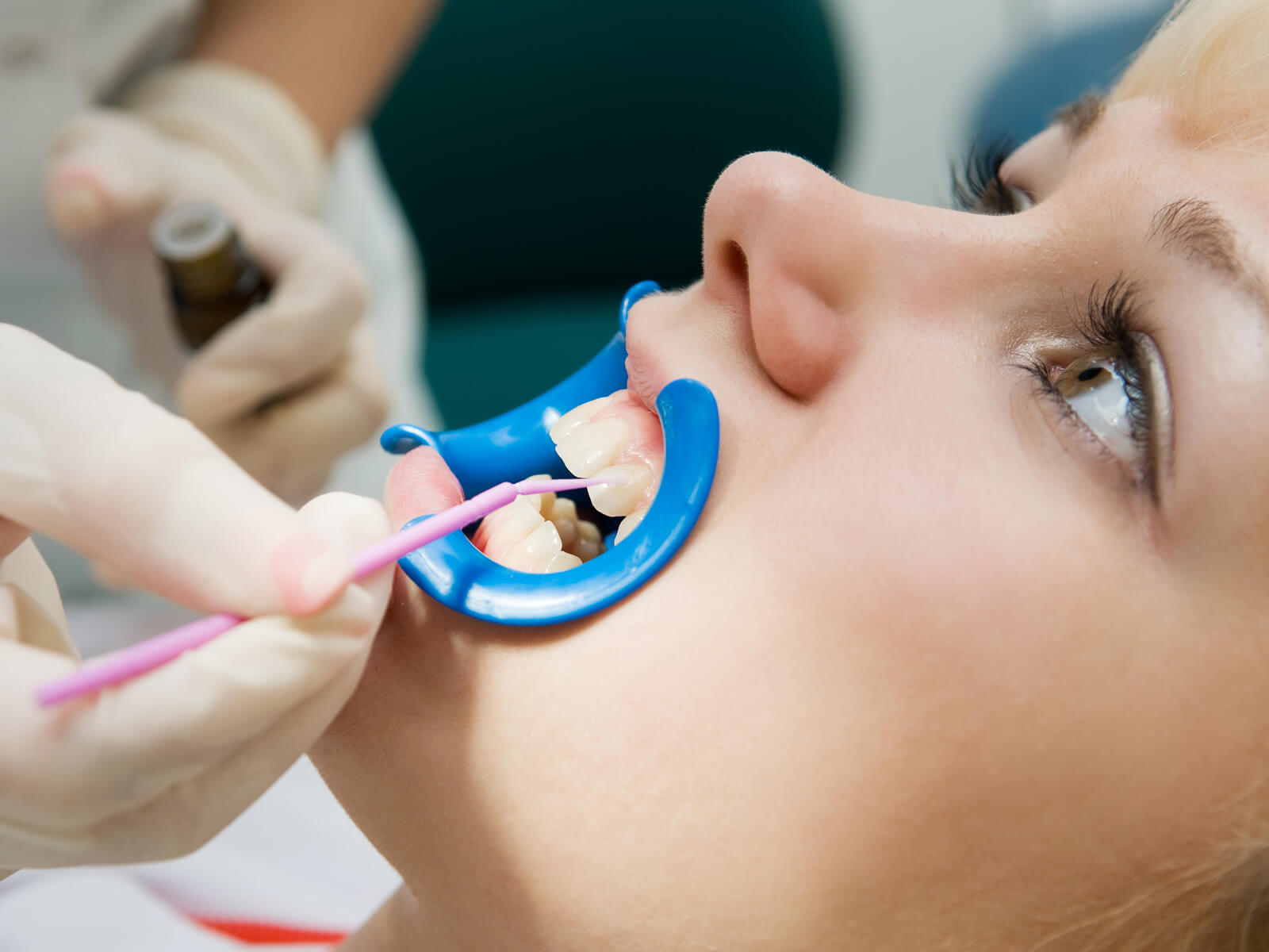Best Dental Hygienist in London