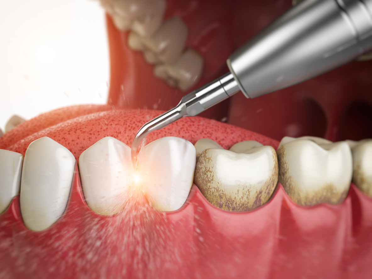 Best Hygienist in London