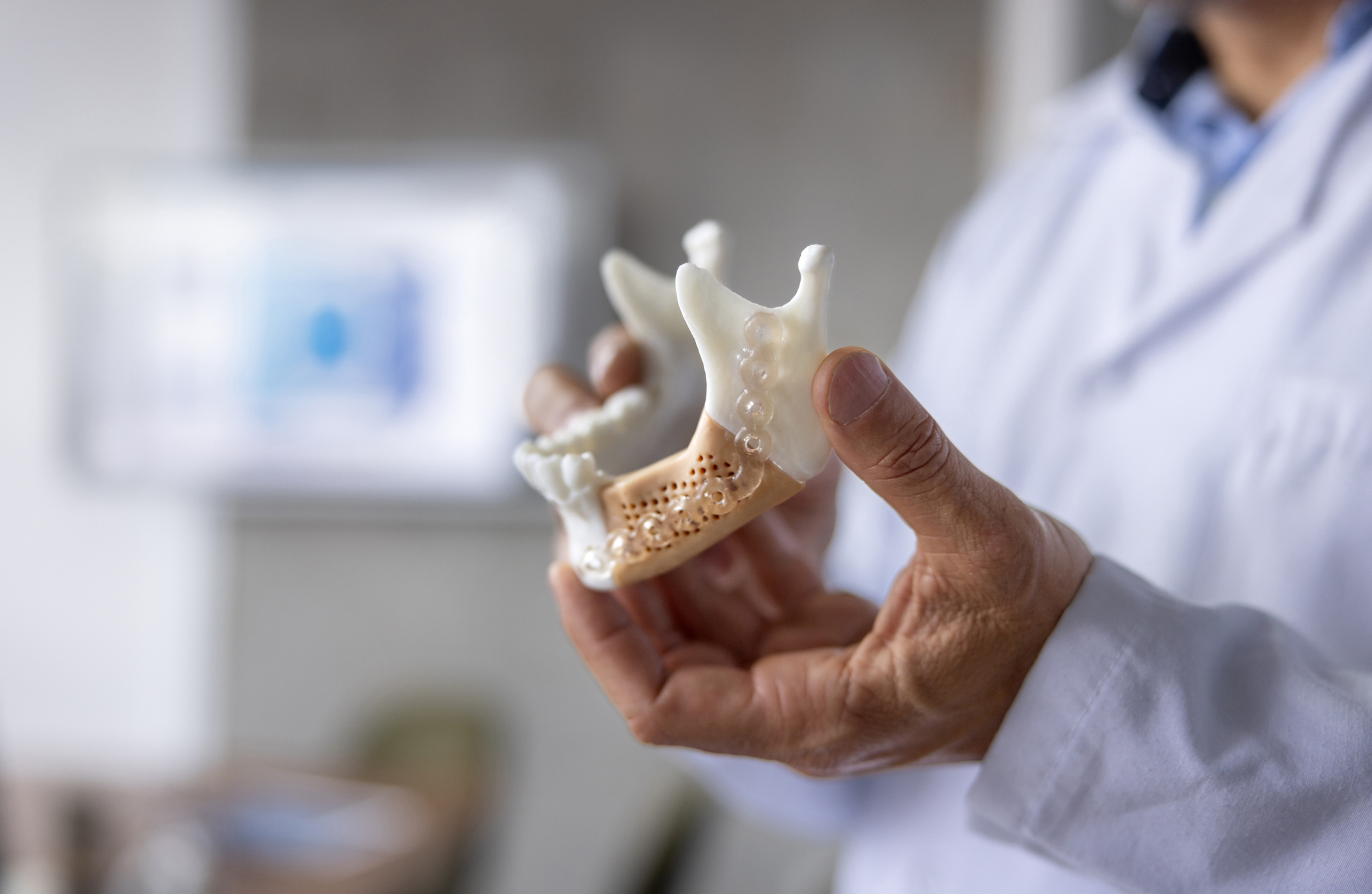 Bone Grafts
