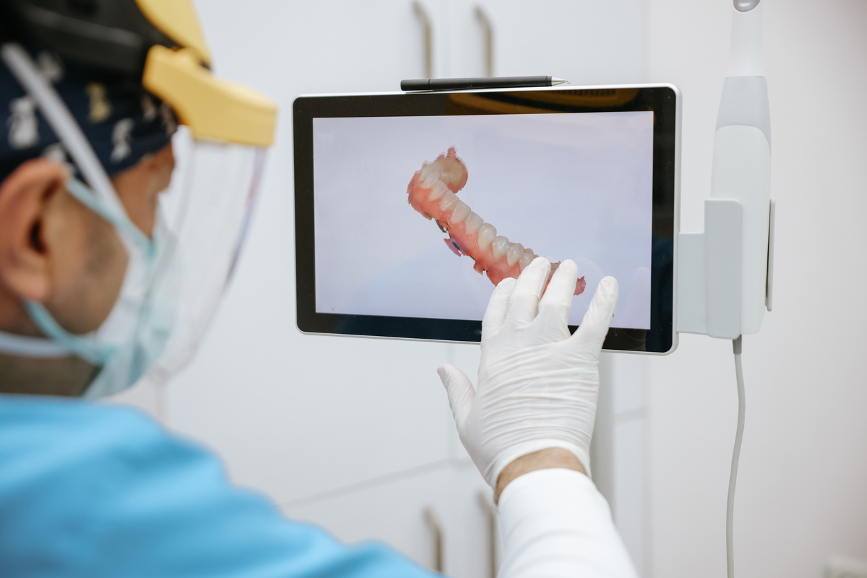 Dental implant procedure and consultation in Kingston