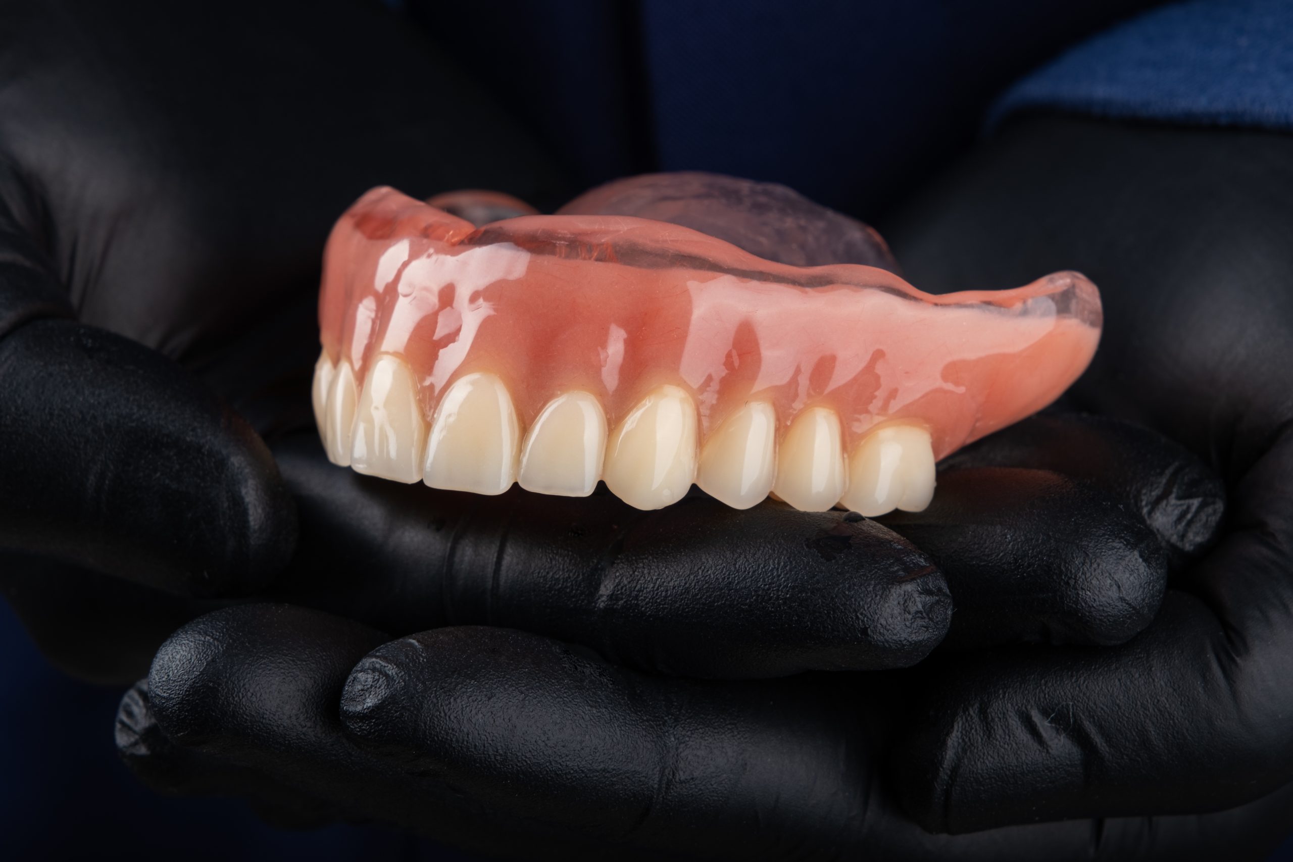 Full Teeth Extraction Cost UK