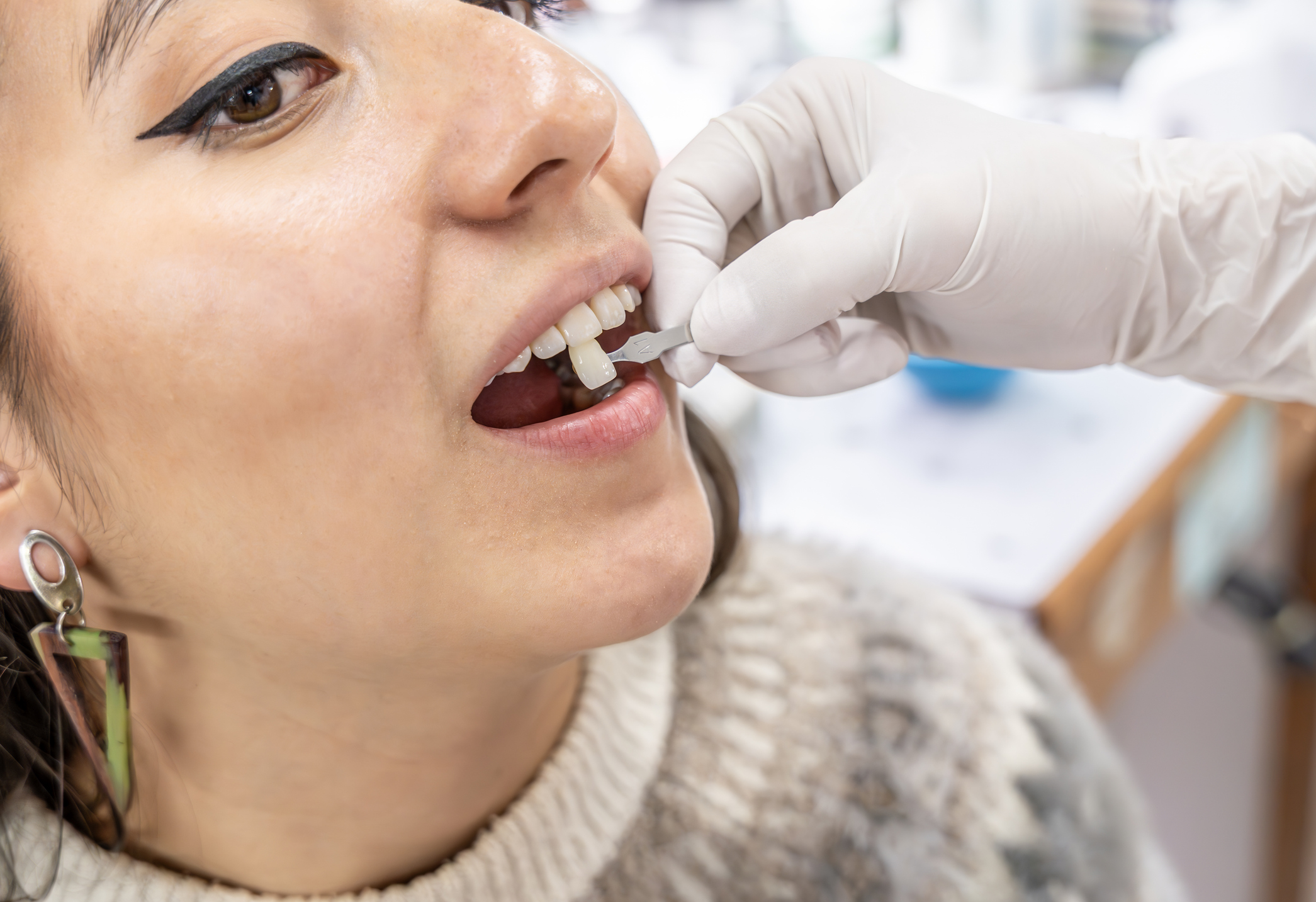 Unlocking your best smile: Everything you need to know about dental veneers